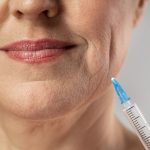 Manfaat Filler Dagu Untuk Mengatasi Perubahan Wajah