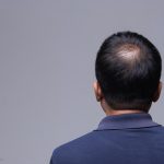 Kenali Pemicu Kerontokan Rambut Sejak Dini
