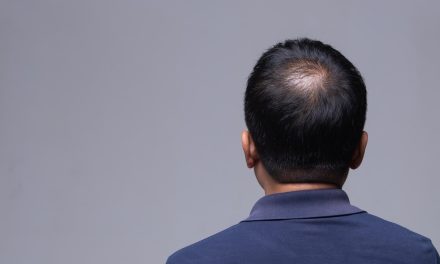 Kenali Pemicu Kerontokan Rambut Sejak Dini