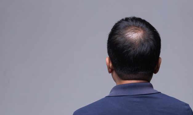 Kenali Pemicu Kerontokan Rambut Sejak Dini
