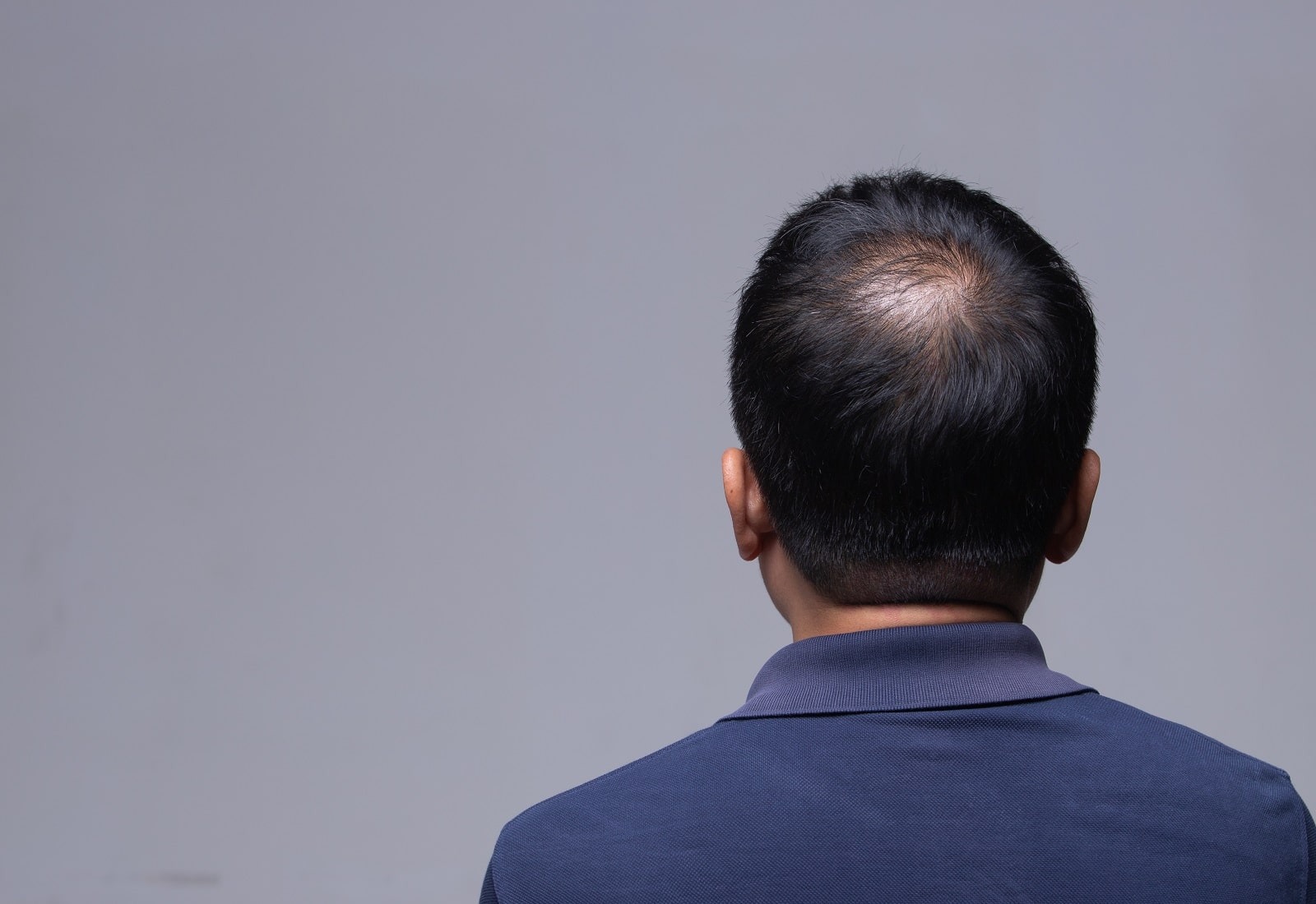 Kenali Pemicu Kerontokan Rambut Sejak Dini